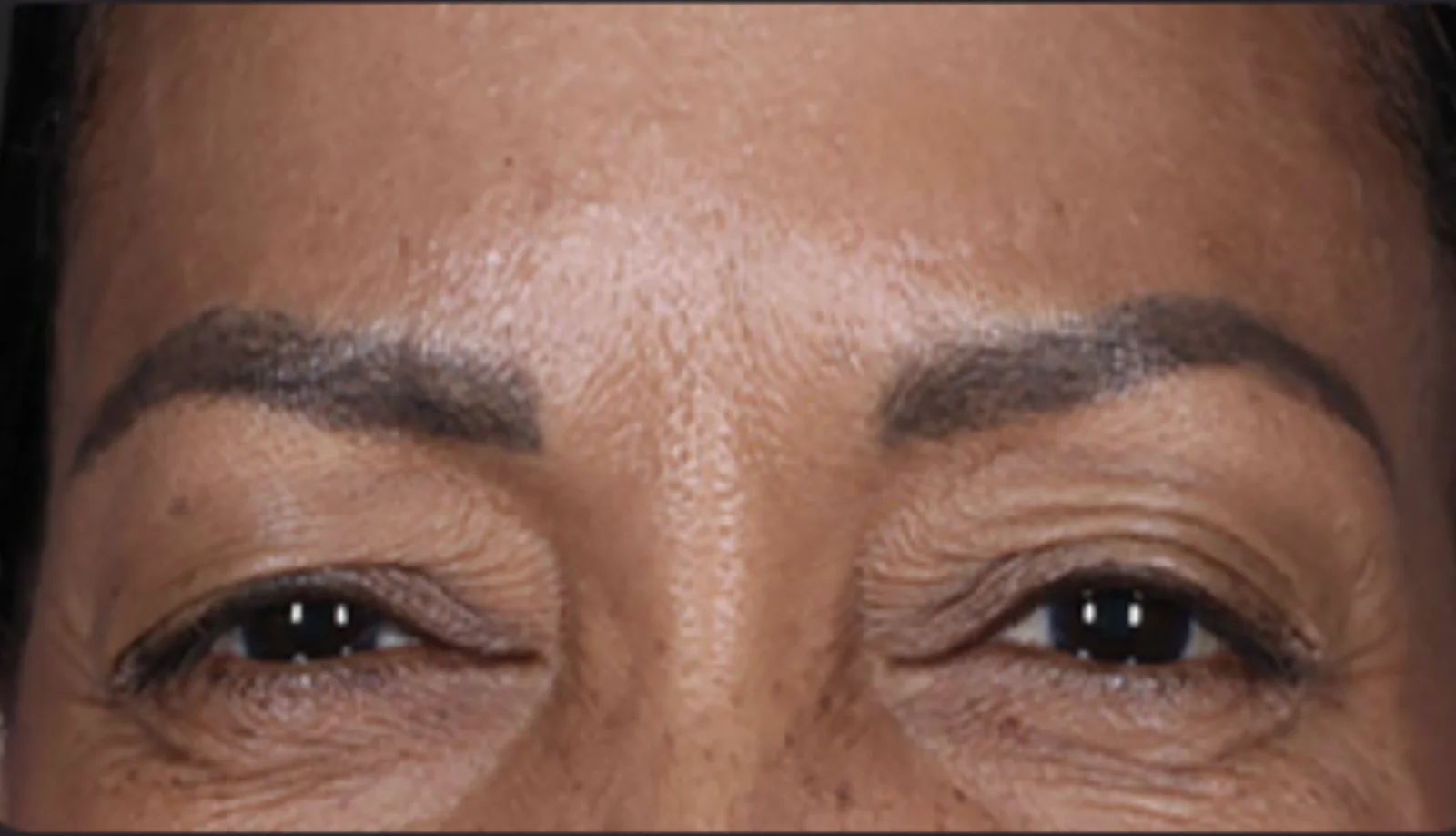 After treatment