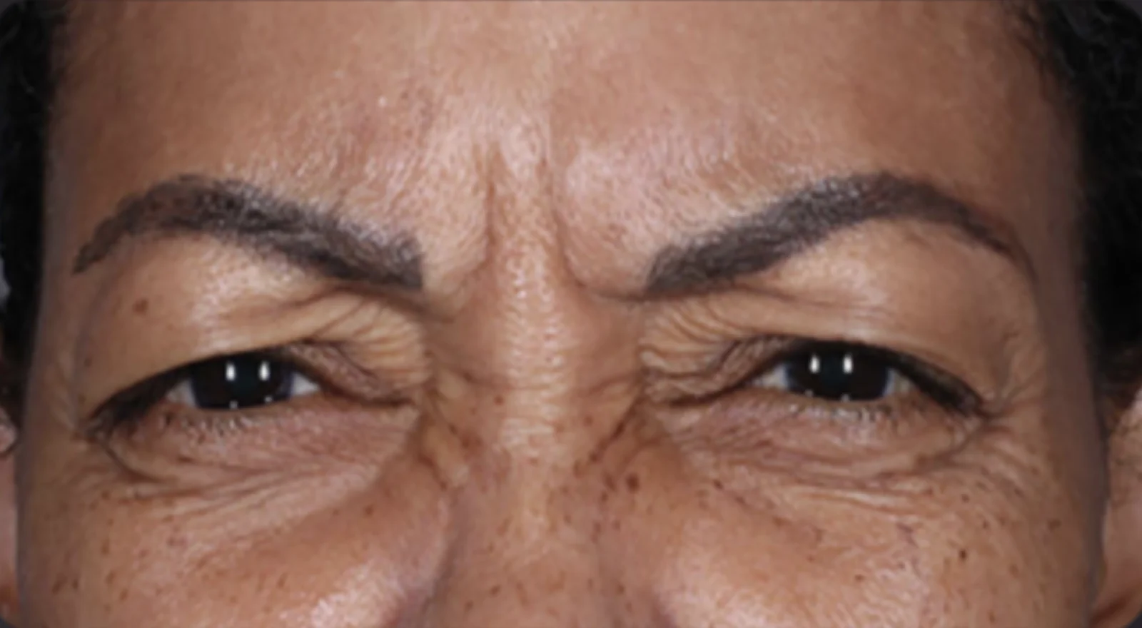 Before treatment