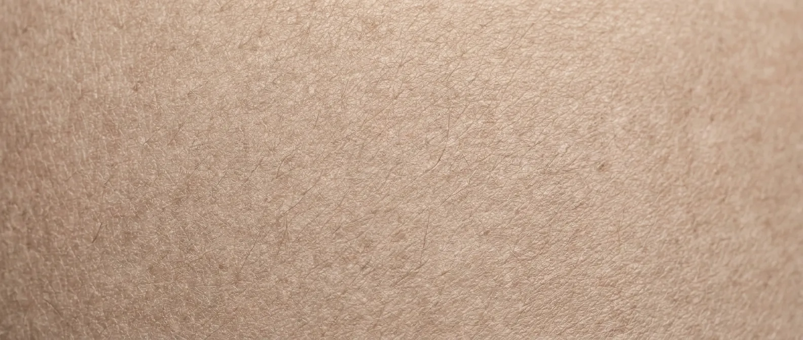 Illustrative rendering of dull, dehydrated skin texture