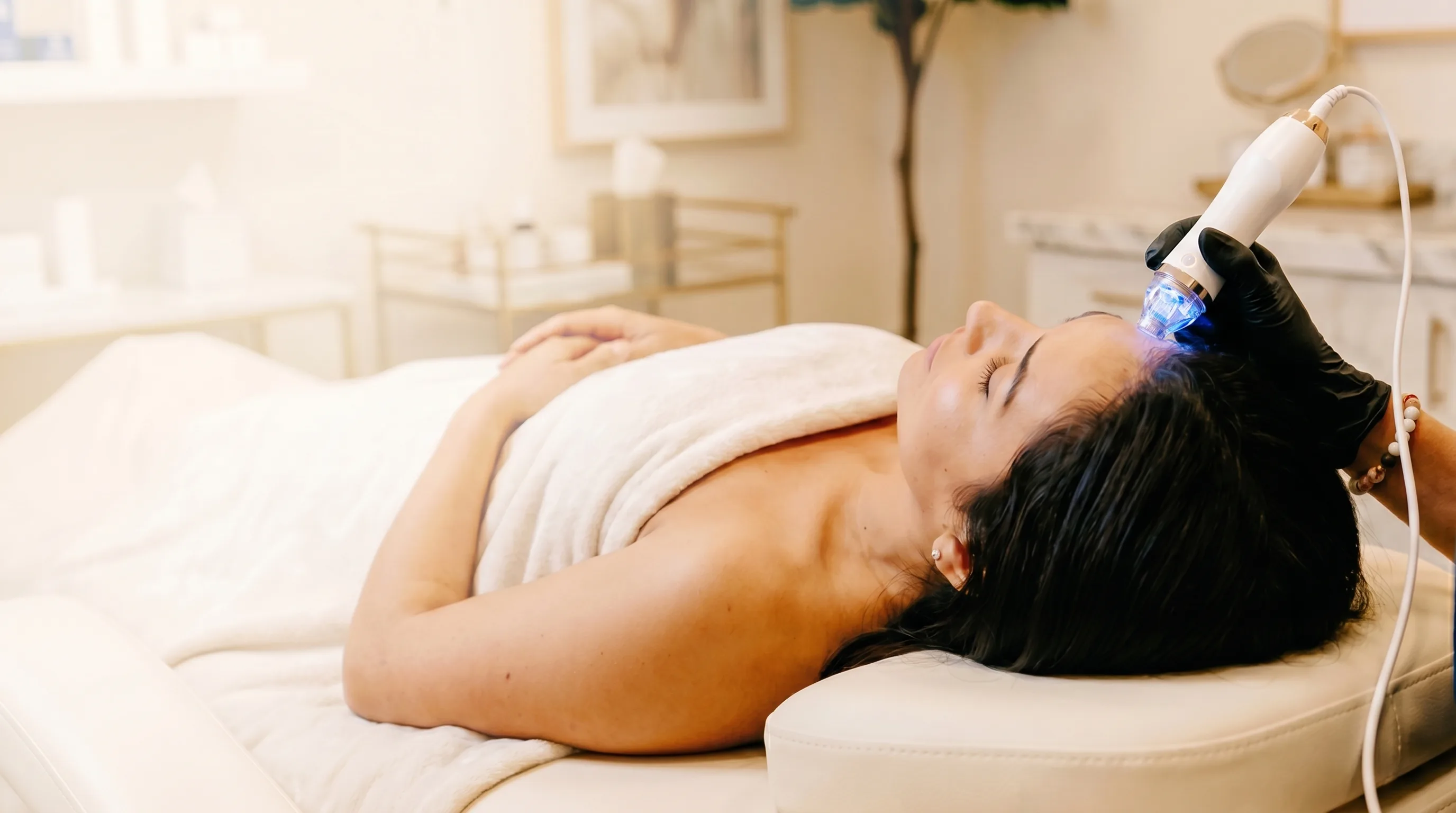 In-office microneedling treatment
