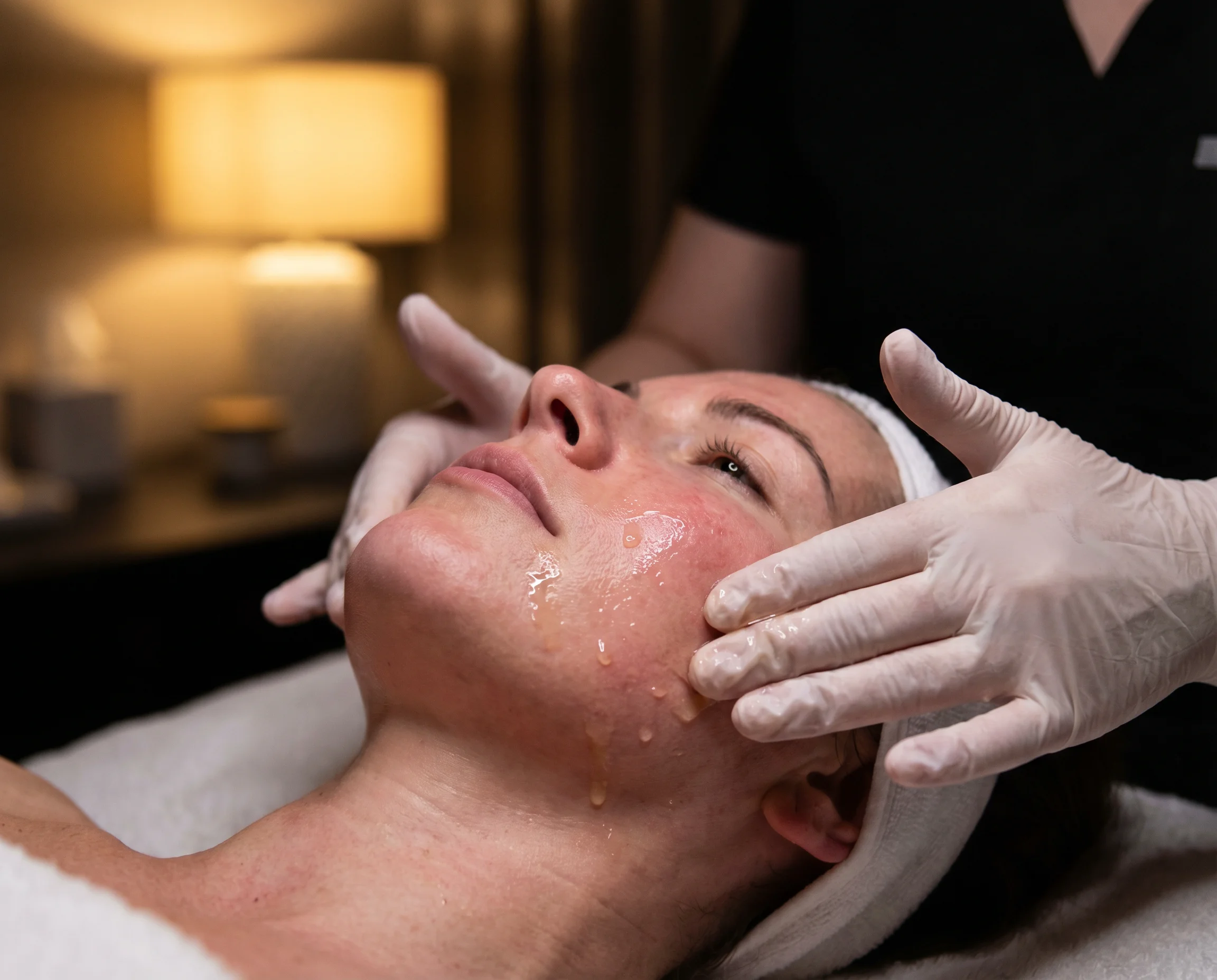 Microneedling creates thousands of microchannels that jump-start collagen.